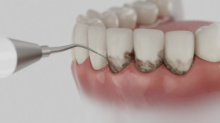 Reliable Teeth Cleaning And Checkup contractor in Cheyenne County County, CO by Dentist Open Now